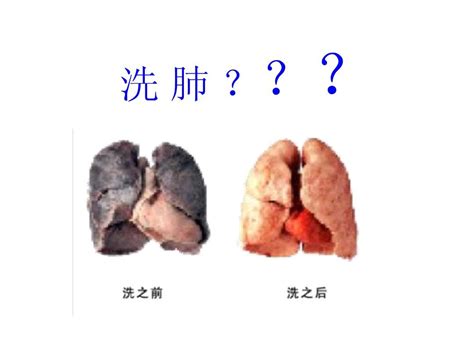 砂肺是什麼